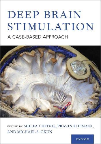 Deep Brain Stimulation A Case-based Approach [Hardcover]