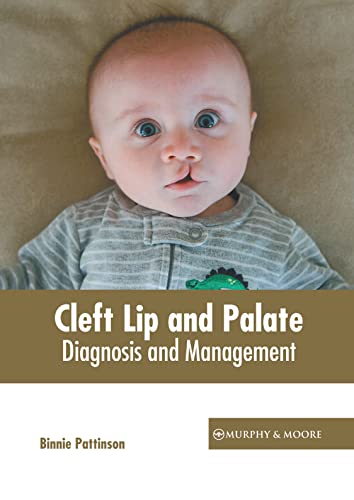 Cleft Lip And Palate Diagnosis And Management