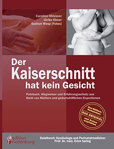 Kaiserschnitt Hat Kein Gesicht - Fotobuch, Wegweiser Und Erfahrungsschatz Aus Si