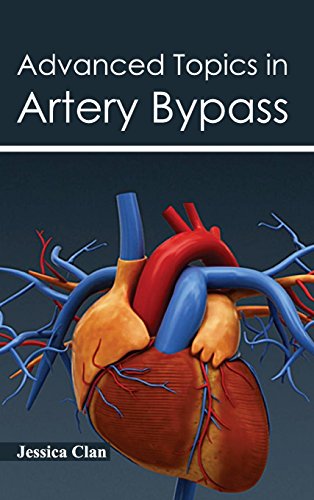 Advanced Topics In Artery Bypass [Hardcover]