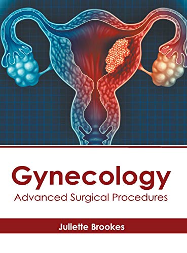 Gynecology Advanced Surgical Procedures [Hardcover]