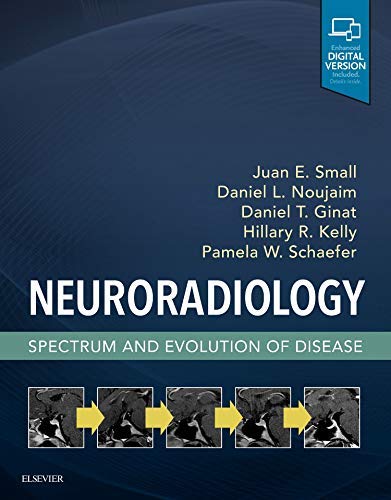 Neuroradiology Spectrum and Evolution of Disease [Hardcover]