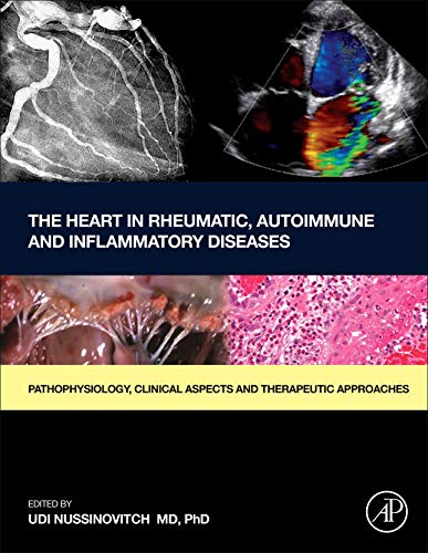 The Heart in Rheumatic, Autoimmune and Inflammatory Diseases Pathophysiology, C [Hardcover]